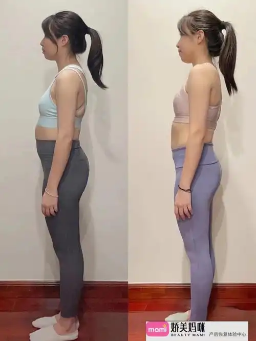 7715分享一组产后对比图7715