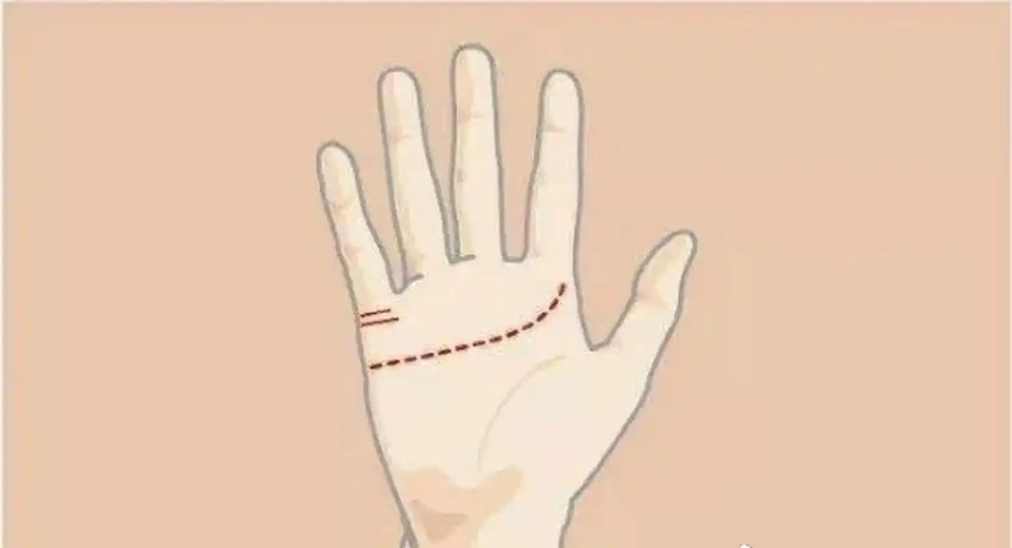 手掌心中有两条婚姻线 有此种手相主能获得温暖的爱情,但即使正式结婚