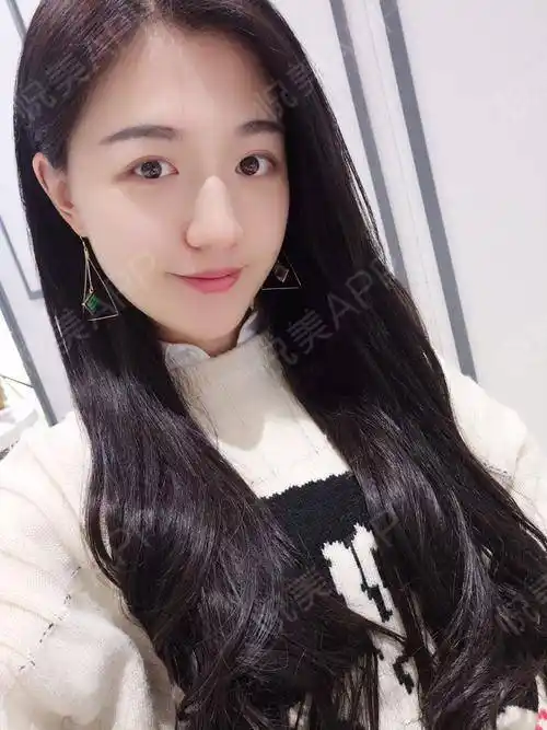 自体脂肪面部填充术后7天_面部填充术后7天_自体脂肪术后7天_面部轮廓