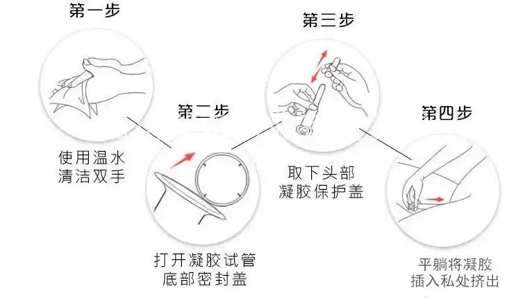 四川默森药业达妇宁妇用凝胶如何使用
