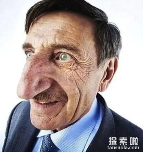 世界上最大的鼻子,长度8.8厘米,巨型大鼻子闻名世界(图1)