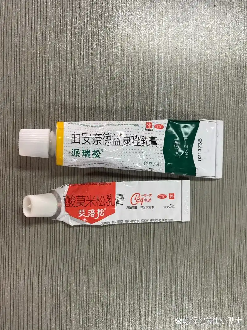 湿疹药膏:派瑞松77艾洛松