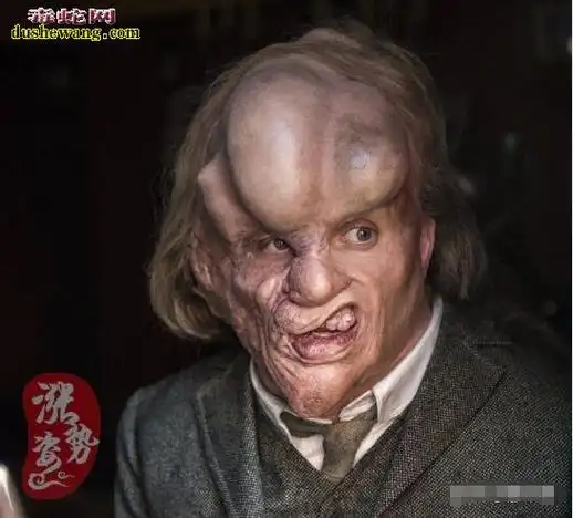 世界上10位最恐怖的畸形人!胆小勿看!