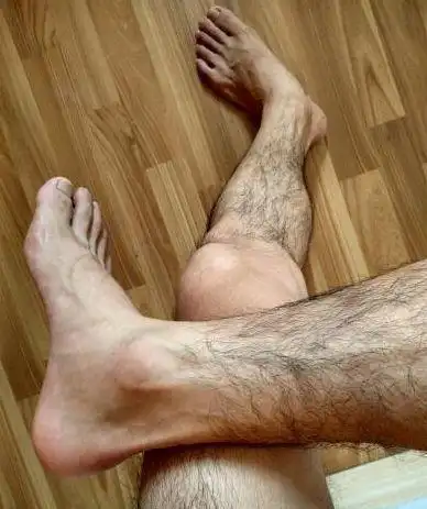 腿毛一方面的作用是身体排汗用,一方面也是身体肾脏是否健康强壮的