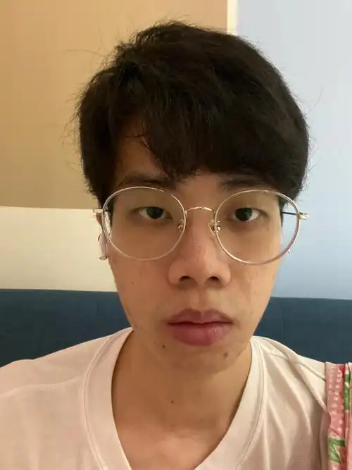 蒜头鼻00怎么办?不隆鼻可以把鼻翼变小吗?