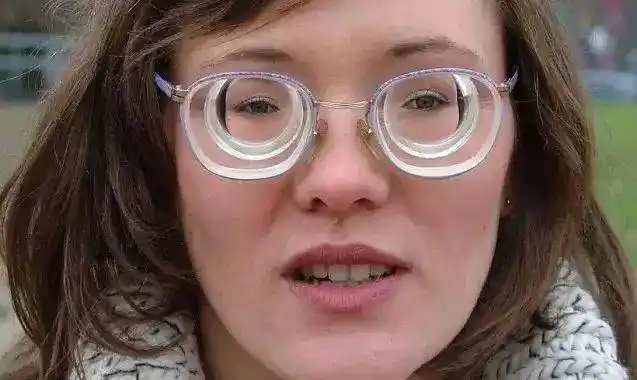 看看2000度眼镜片有多厚!_手机搜狐网