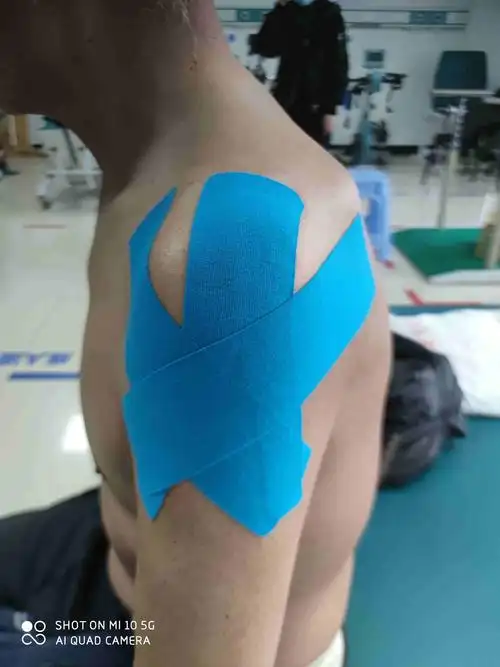 案例13 肩痛痛到睡不着觉了,怎么办?