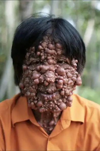 密集吧_百度贴吧