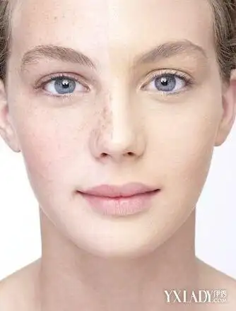 脸上肤色不匀怎么办完美应对肤色不均法则