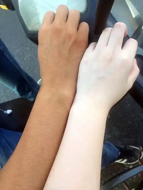 【如何拥有白皮肤/美白过程】