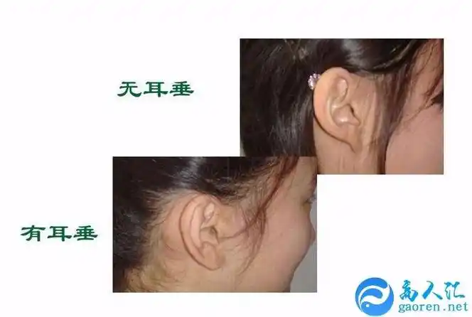 耳朵看相算命图解之没有耳垂的人面相分析