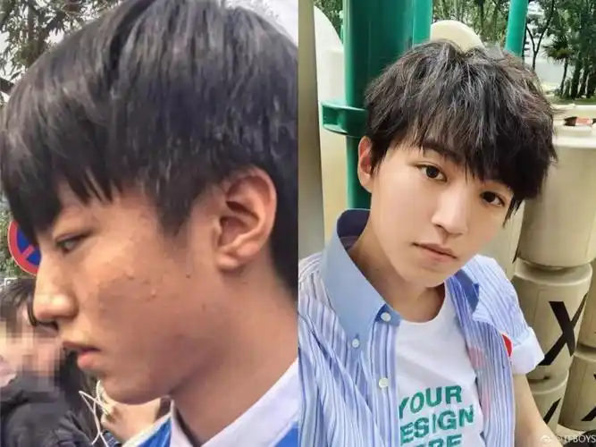 殿堂级网红祛痘神物你get了吗?