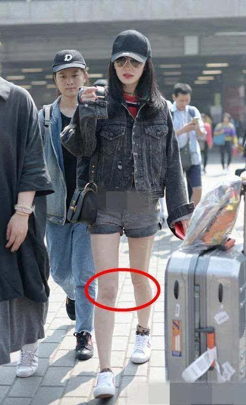 杨幂膝盖一不小心被p成波浪状