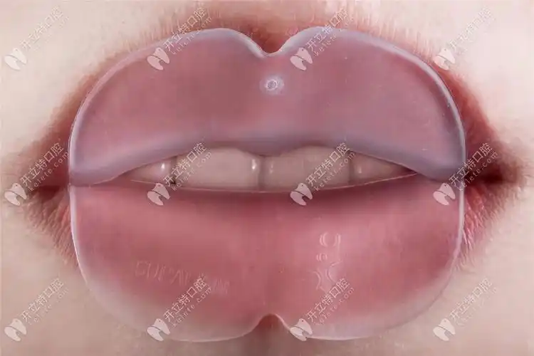 牙贝美塑嘟嘟嘴吞咽辅助训练器的作用,来了解下