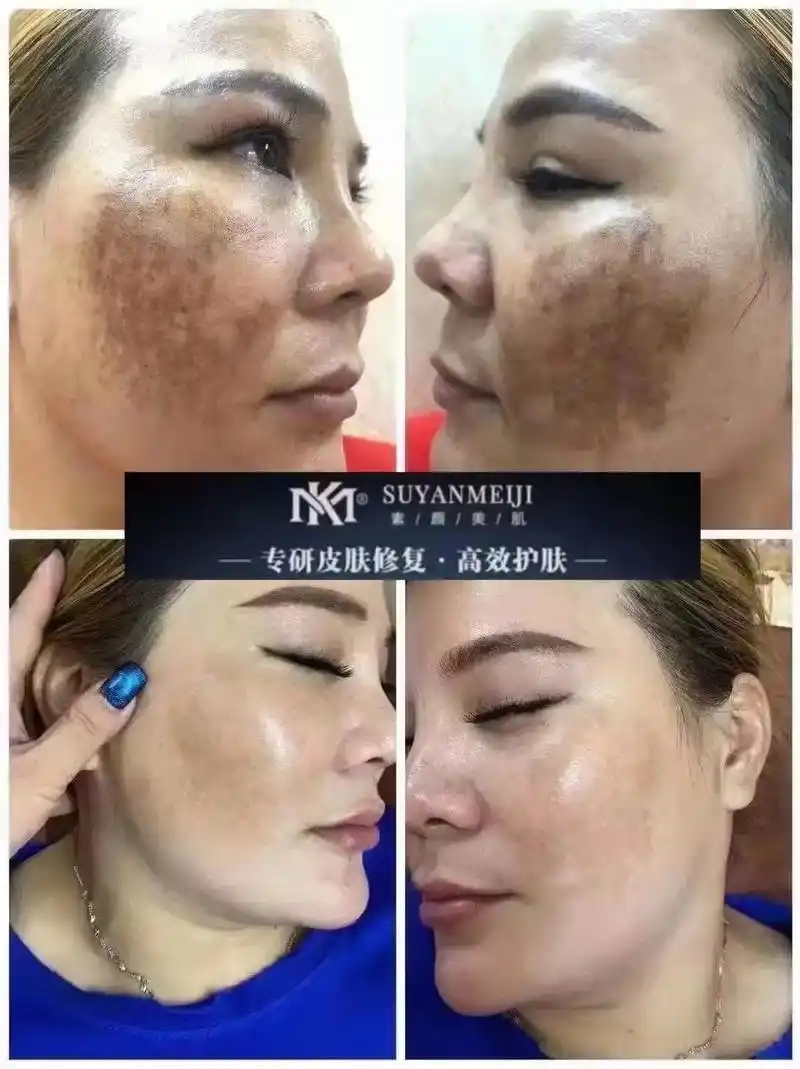 a一 专研皮肤修复·高效护肤 mk素颜美肌 使用净肤液一瓶 - 抖音