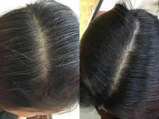 为什么欧阳氏的欧阳医师可以担保-白发转黑不是难题!