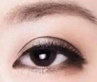 无痕双眼皮收费标准【如何收费】