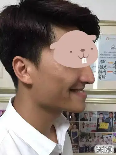 美然是什么阻止你皮肤美白皮肤管理问与答