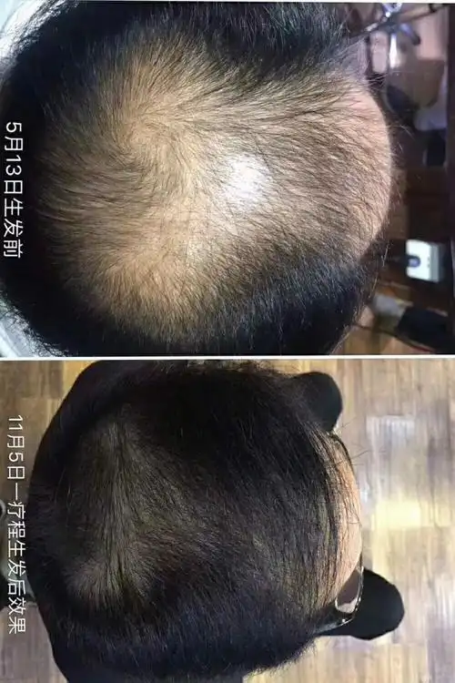 沐禾生发养发馆