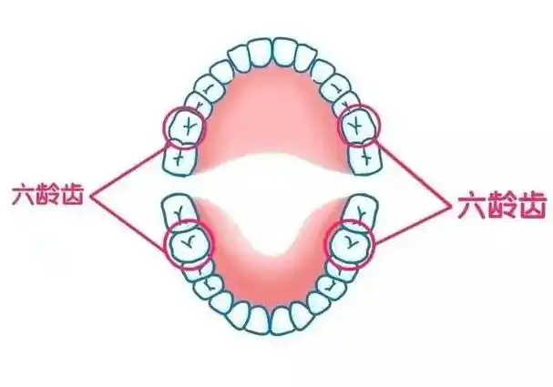"六龄齿",学名"第一恒磨牙",在孩子6岁左右萌出,上下左右各一颗,因此