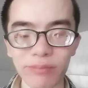 高度近视有4000千到5000千之间吧我现在带的眼镜是3000度左耳听力0