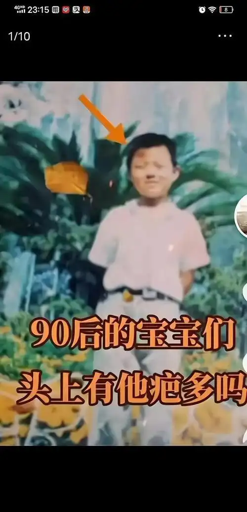 郭威的伤疤流着许敏伤心的泪我以同样的经历提4个问题