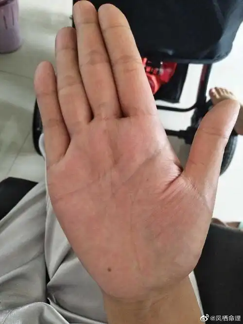 金星丘上面竖纹密布,说明你感情是比较丰富. 来自凤栖命理 - 微博