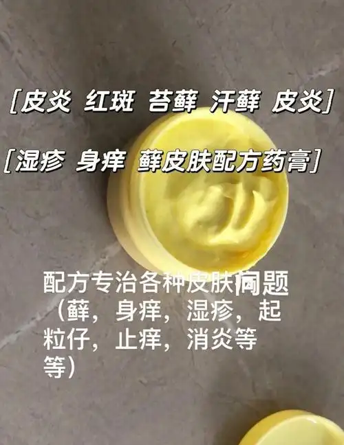 皮肤顽固湿疹藓身痒皮炎都可来找我配药膏