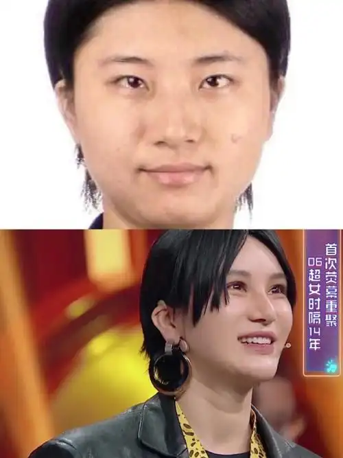 尚雯婕 整容成功吗?