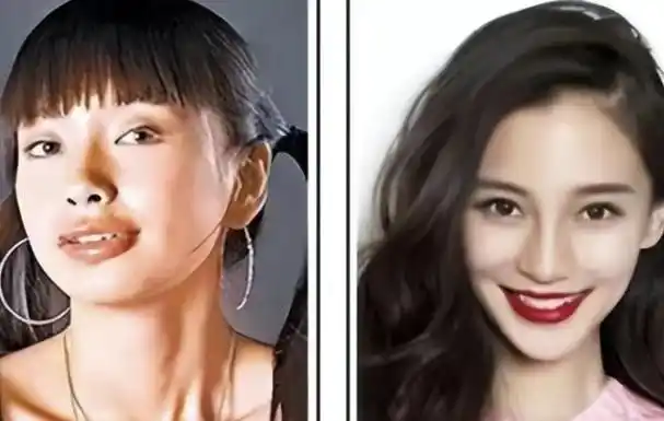 整容成功的4位"妈生脸",没整前是路人脸,整容后颜值哇塞