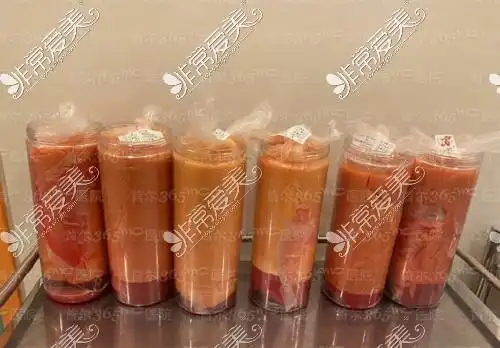 6,脂肪栓塞抽脂手术中非常可怕的问题就是脂肪栓塞,指的是被破坏的