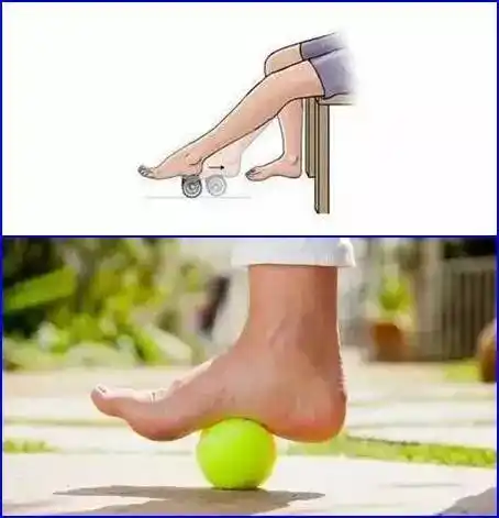 足底筋膜炎的治疗与康复细说足底筋膜炎二