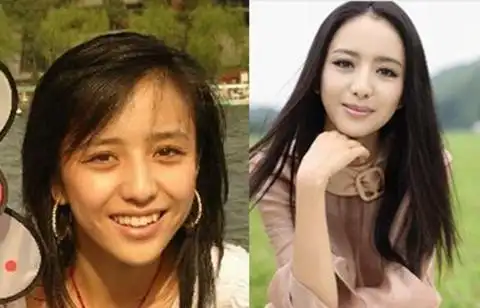 佟丽娅整容前后对比照-三元整形网