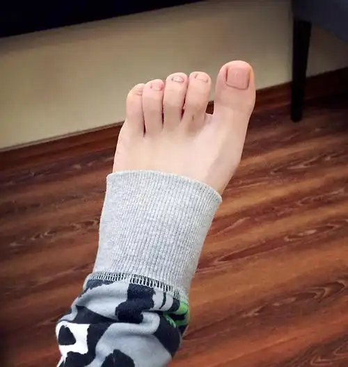高跟鞋更不敢穿,因为脚趾头疼… 整个高中时期还得了甲沟炎,就是指