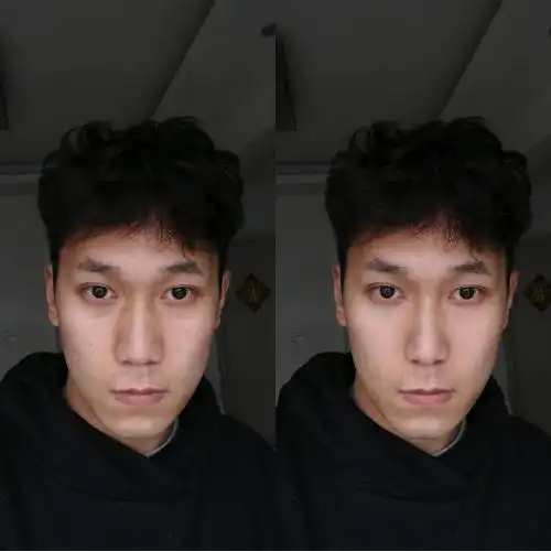 侧面照看上去,除了鼻头鼻翼肥大的问题,还有一个比较明显的情况是:鼻