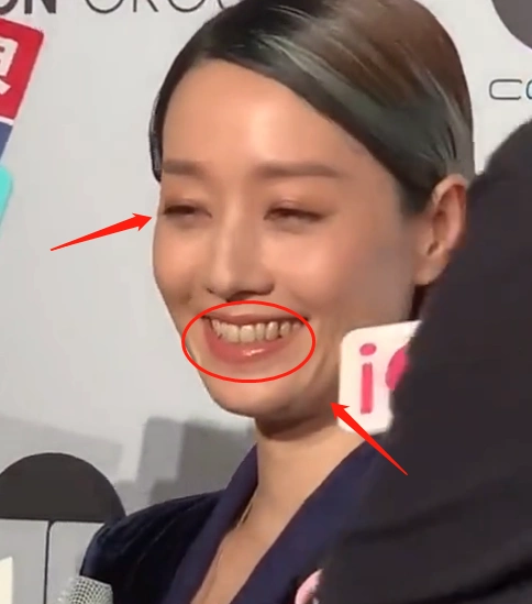 45岁马伊琍活动被拍,生图被指跟本人差距大,网友:换个头吧