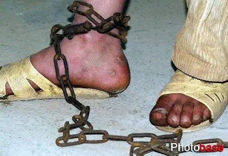 顽皮男童由祖父母带养遭铁链锁脚组图