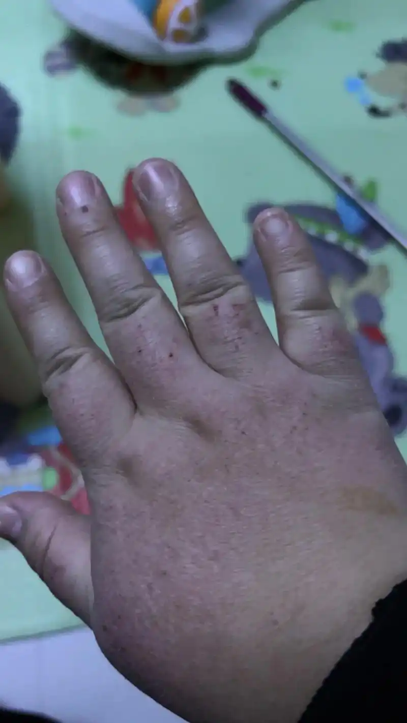 干活的手 #手干燥粗糙 #这手干巴干巴的 #扛住扛不住都得 - 抖音
