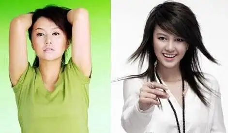 怎么擦能让脸胖起来 除了整容.