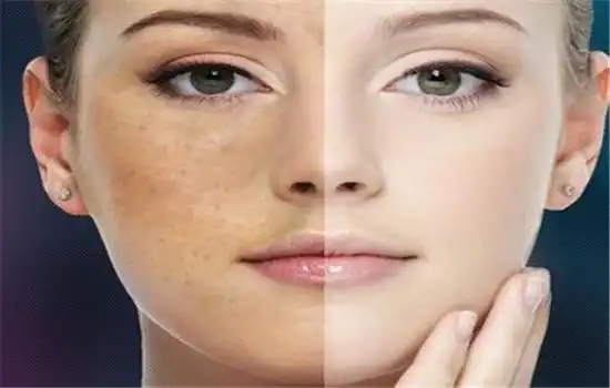 能美白去黄的护肤品 暗黄皮肤怎么美白