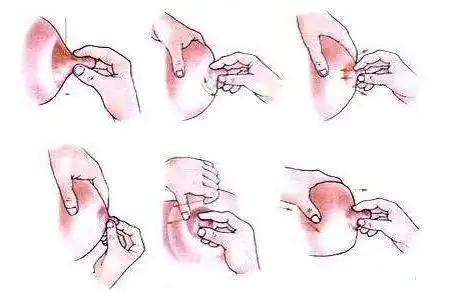 20.二十岁的女性还没有乳头怎么办