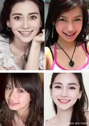 牙齿对颜值的影响有多大?来看看明星整牙前后的对比!