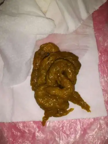 看宝宝大便颜色,识健康,宝妈必学!