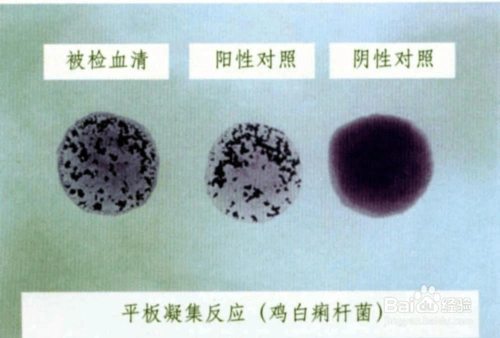 凝集试验结果判定