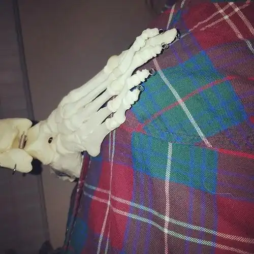 因癌症被截肢后 她和截掉的断脚成了自拍小伙伴