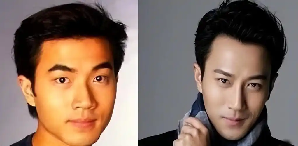 从他后来的作品中可以看出,刘恺威割了双眼皮,还做了鼻综合,提高了