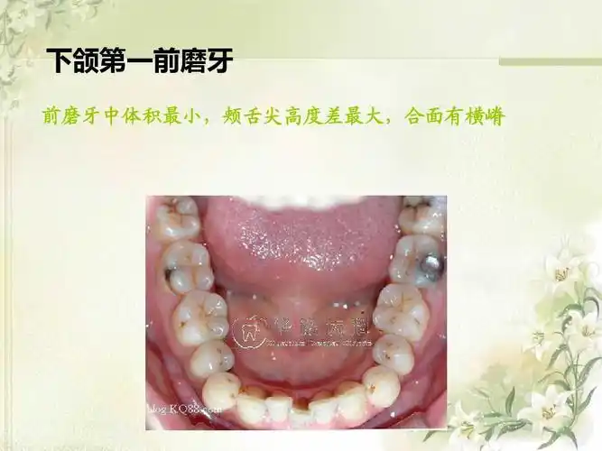 下颌第一前磨牙 前磨牙中体积最小,颊舌尖高度差最大,合面有横嵴