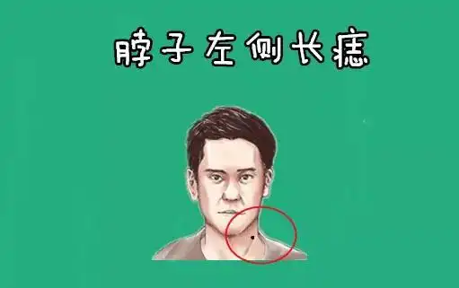脖子左侧长痣在相学当中,若是一个人的脖子左侧的位置处长有恶痣,则