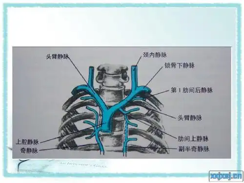 中心静脉置管护理及中心静脉压的监测ppt