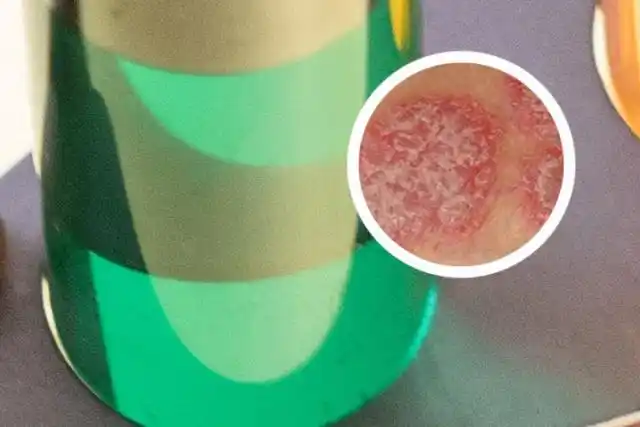 扫一扫图片识别皮肤病-扫图识别什么皮肤病_黑龙江盛京皮肤病医院